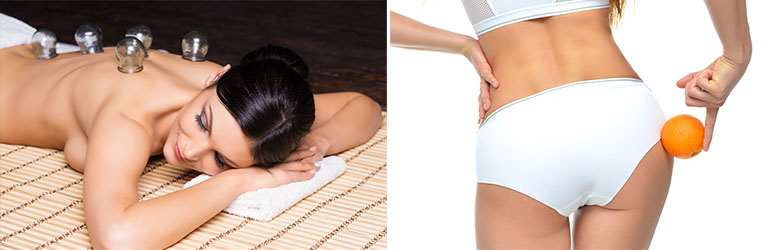 Látogass el a Hajsza Szépségszalonba a Brigi Kozmetikába, ahol búcsút mondhatsz a narancsvidéknek és igent mondhatsz a makulátlan bőrre, formás szemöldökre! DD kuponnal nagy kedvezménnyel